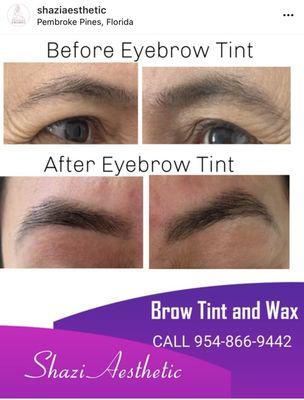 Eye Tint
Before and After