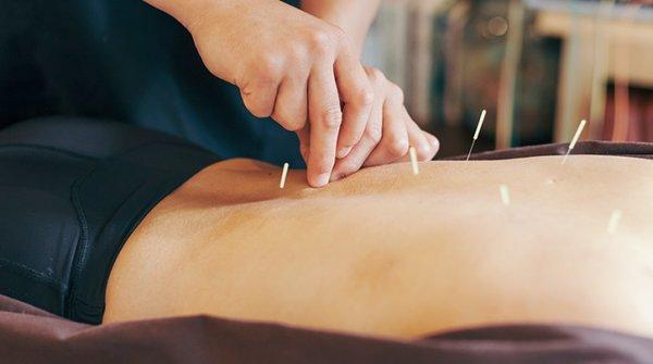 Acupuncture of Greater Hartford and Springfield