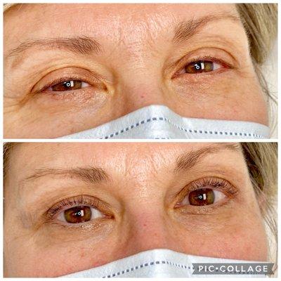 Eyelash Lift & Tint