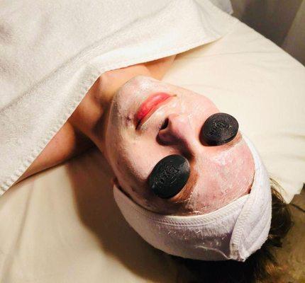 Acne Facial!