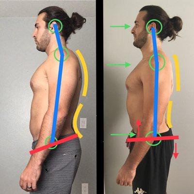 12-week posture improvement!