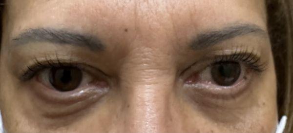 Lash lift