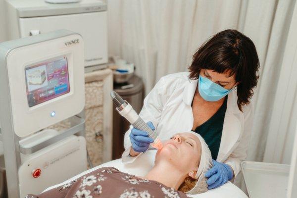 Vivace Radiofrequency Microneedling