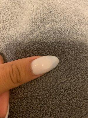 Cuticle over a week and still healing