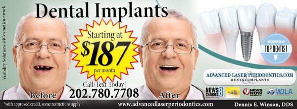 Dental Implant Repair and Painless Dental Laser Correction