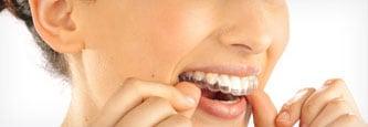 Invisalign® clear aligner treatment provider