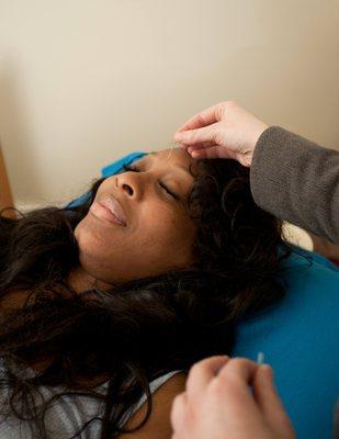 acupuncture patient 2