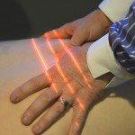 Cold Laser Therapy for Pain Treatment