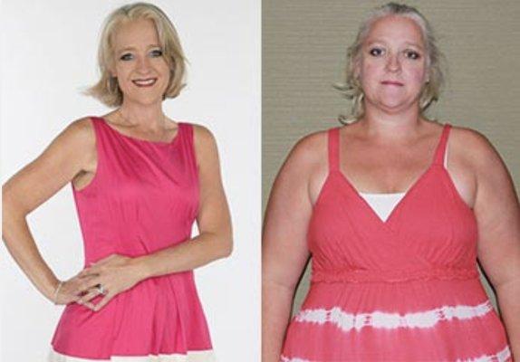 Ladonna lost 138 pounds with sleeve gastrectomy surgery.