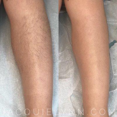 Full Leg Wax - Before & After