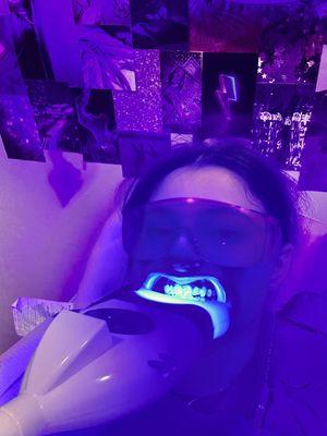 The teeth whitening process :)