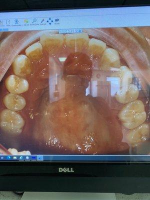 Before 0/7 trays, 11/2020