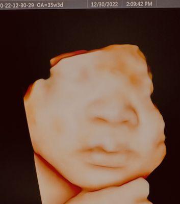 Book your 3D/4D ultrasound with us today!