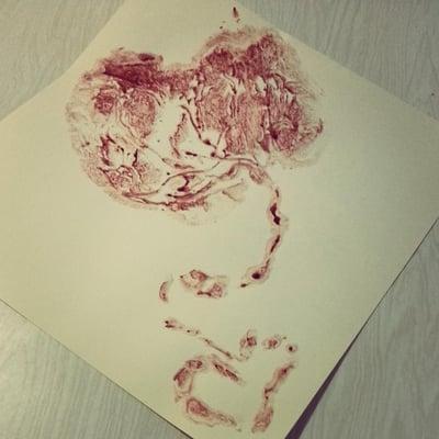 Placenta Prints