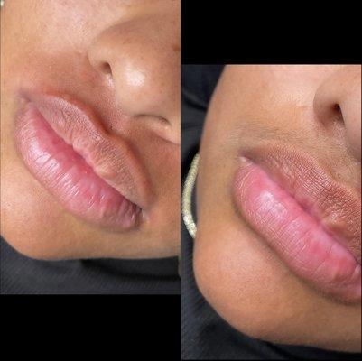 Lip wax before and after