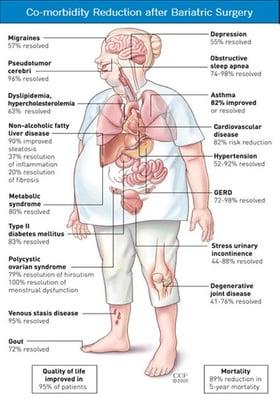 The Center for Metabolic and Obesity Surgery, the private metabolic surgery practice of Dr...