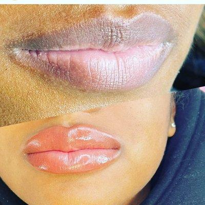 Lip pigmentation