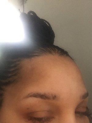 No pigment on the start of brow.