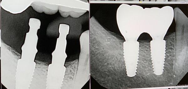 Contemporary Periodontics & Dental Implants