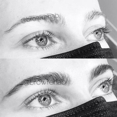 Eyebrows before and after Brow Rehab first visit