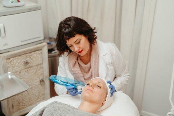 Microneedling