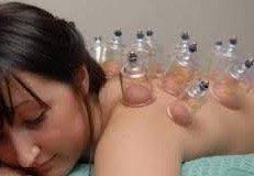 Cupping Therapy