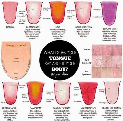 TONGUE DIAGNOSIS  (Whole Body Consultation)