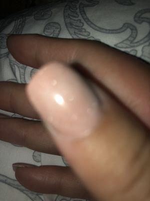 It's a bit difficult to view in pictures with the lighting but i have White bleach looking blob spots in my nails.