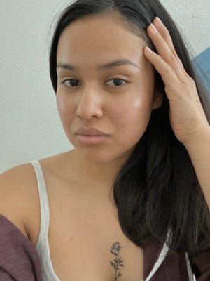 Enzyme peel facial glow