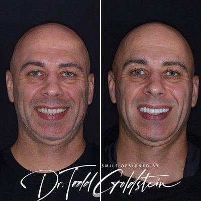 Before & After Results from The Smile Aesthetic | Red Bank, NJ