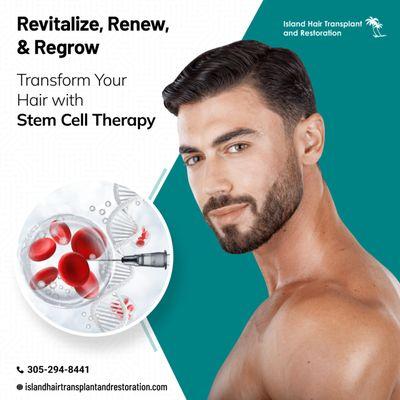 Island Hair Transplant and Restoration