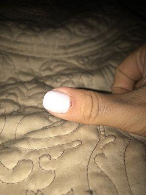 Ripped my cuticle, 3 days healed and still painful