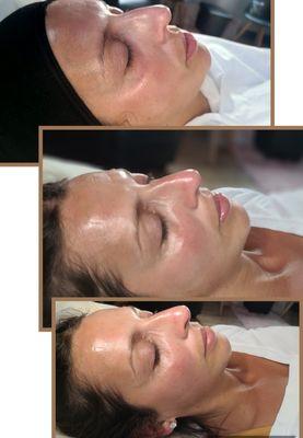 Rejuvenate Me facial