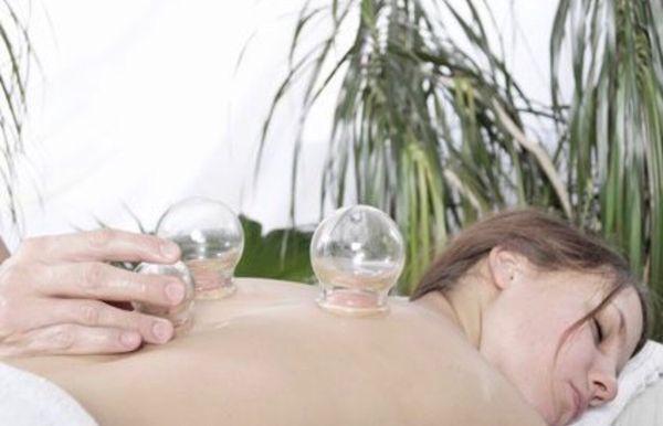 Cupping Therapy