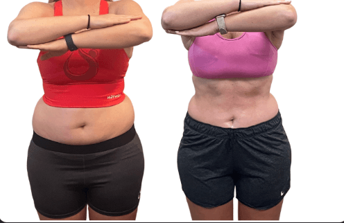 Consultation vs. 3 laser lipo/cavitation treatments + appetite control spray HANGRY-LESS and Fresh Start Detox