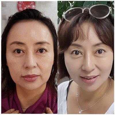 Before and after facial massage treatment