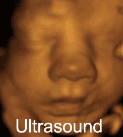 2d 3d 4d Ultrasound