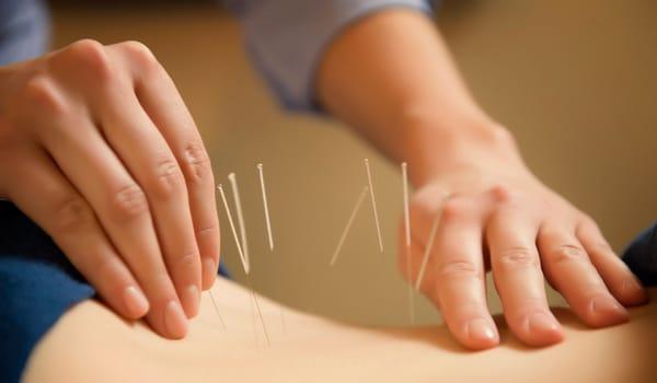 Enjoy acupuncture today!