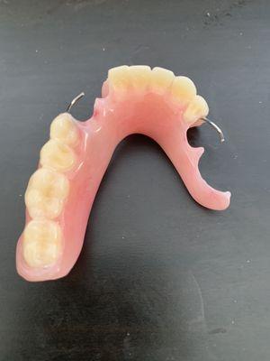 Broke tooth repair, cracked denture repair