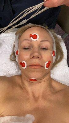 Ridustar- muscle stimulation, facial fitness