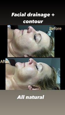 Lymphatic Drainage Face Lift Massage - First Time Client 50%OFF