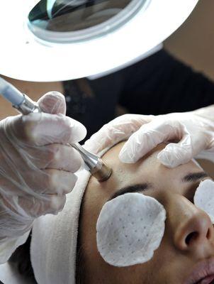 Facial, microdermabrasion