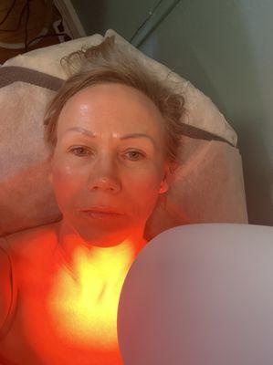 Bioptron light therapy