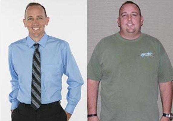 Michael lost 145 pounds with gastric sleeve surgery.