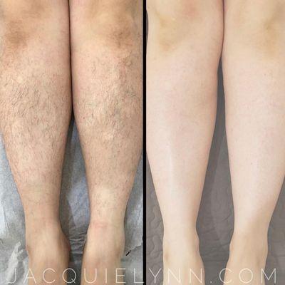 Leg wax - before and after