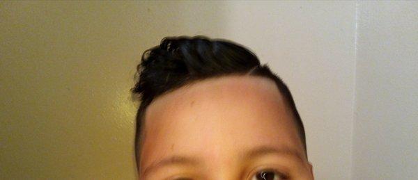 Messed up hairline