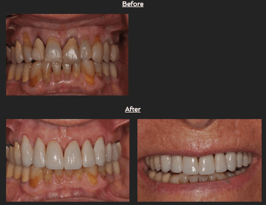 Our Dental Work - Example #1