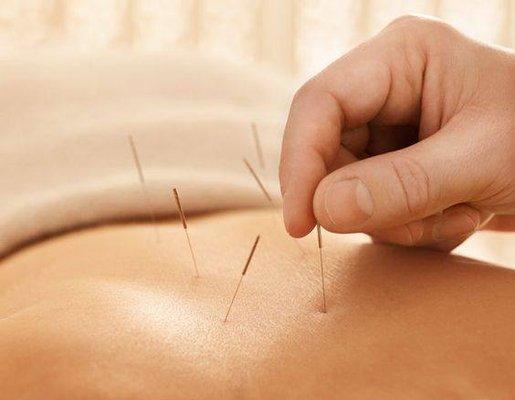 AAHOM Acupuncture Clinic