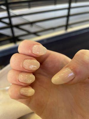 Bumpy uneven gel