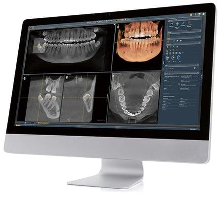 3D Digital Cone Beam CT Scan